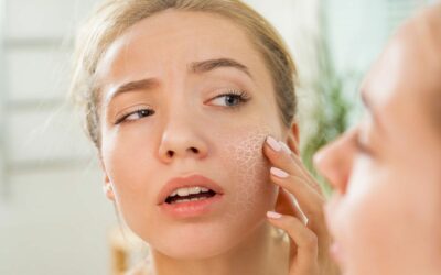 Tratar e prevenir a pele seca pós-verão